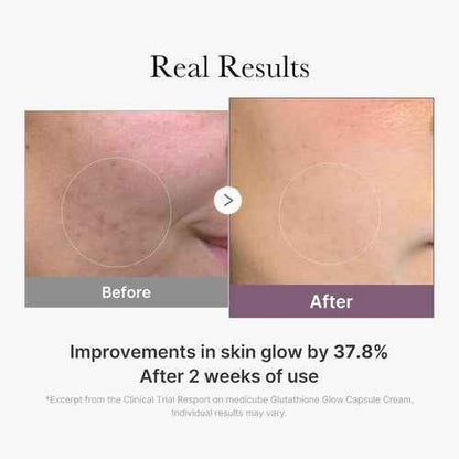 Medicube AGE-R Glutathione Glow Capsule Cream - Illuminate Your Skin with Medicube Glutathione Glow Cream