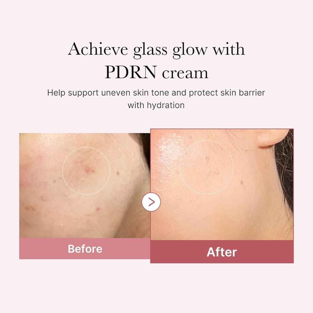 Medicube PDRN Pink Cream - Advanced Hyaluronic Moisturizing for Radiant Skin